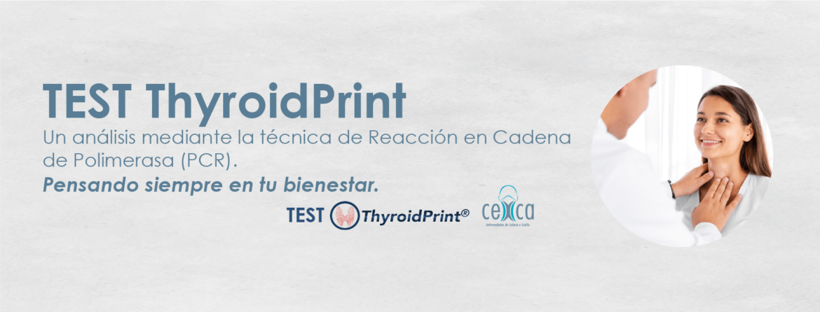 Banner-web-Cexca-TEST-ThyroidPrint.png