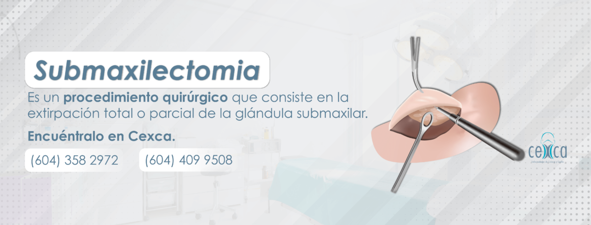 Portada-Cexca-para-web-submaxilectomia-1.png