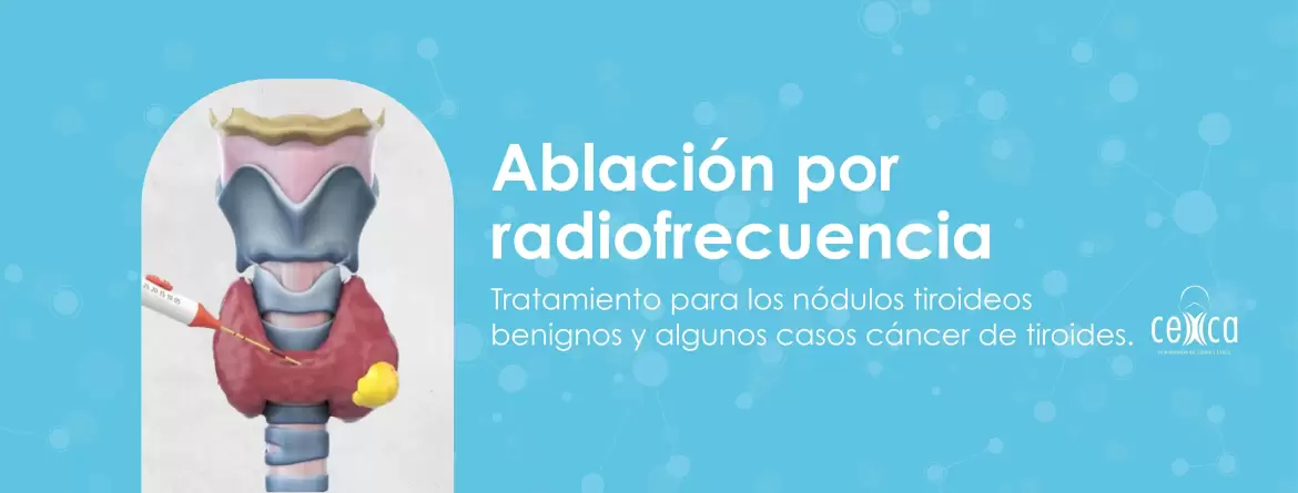 Ablacion-por-radio-frecuencia-banner-2-1.webp